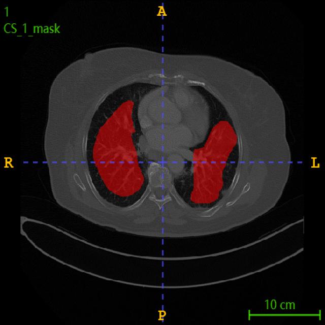 Dataset Image