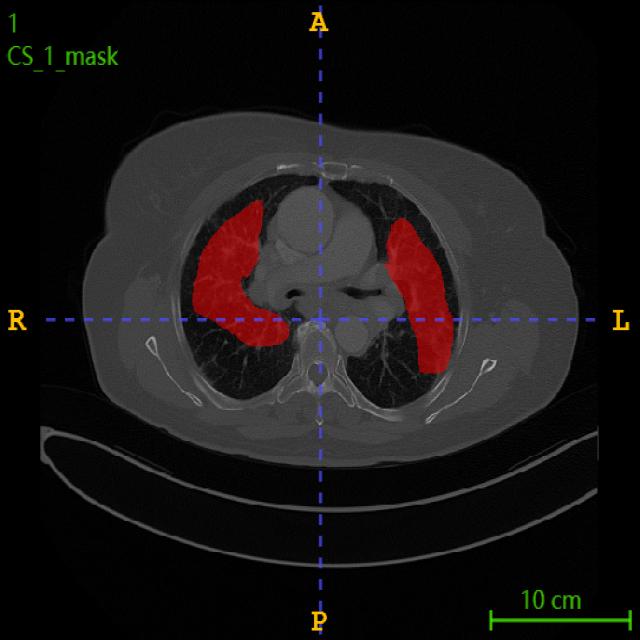 Dataset Image