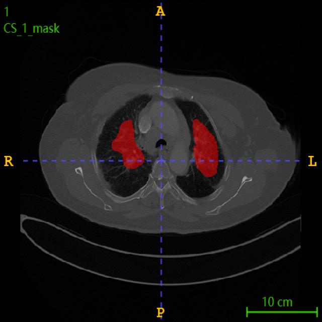 Dataset Image