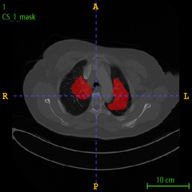 Dataset Image