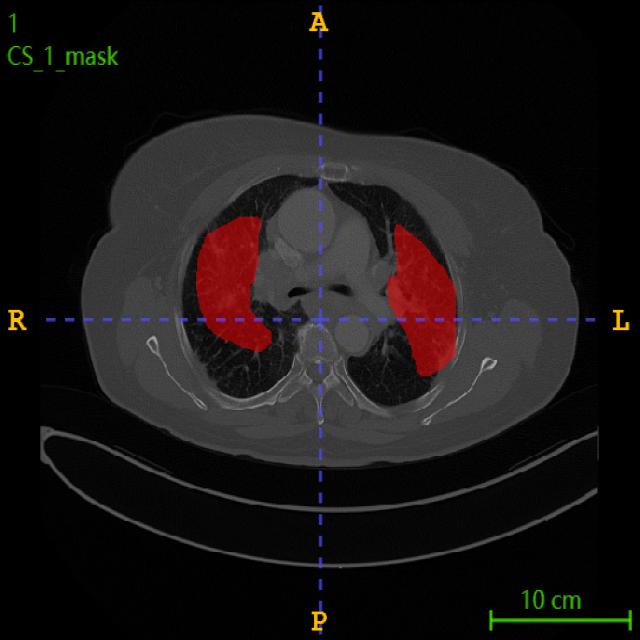 Dataset Image