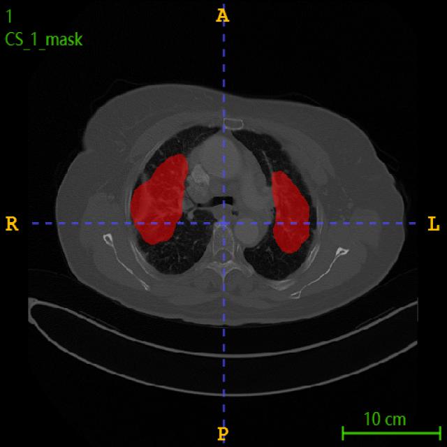 Dataset Image