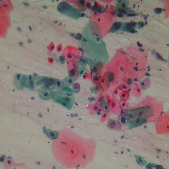 Dataset Image