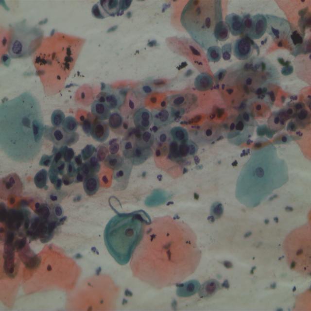 Dataset Image