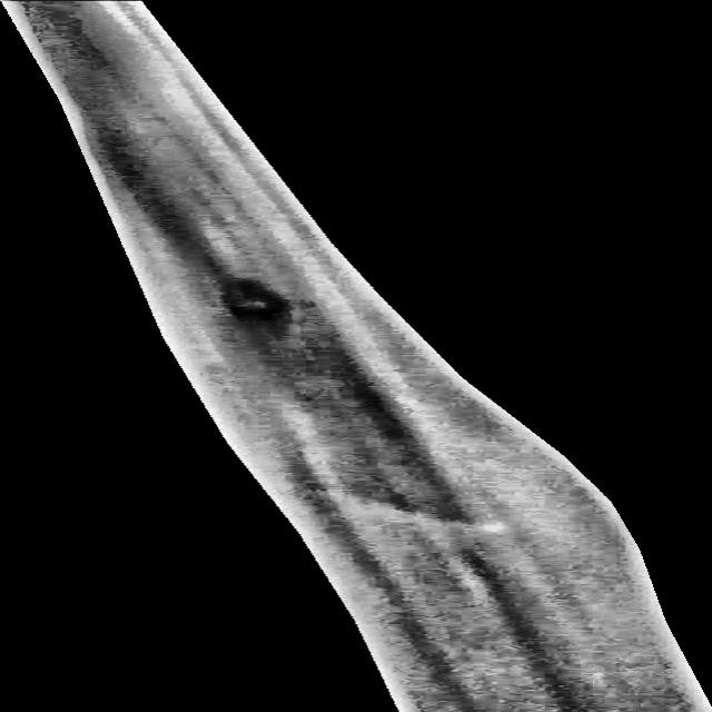 Dataset Image