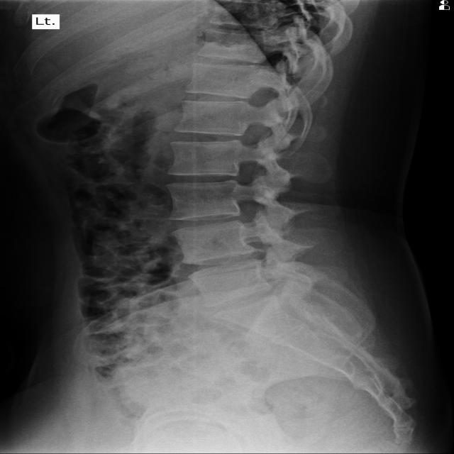 Dataset Image