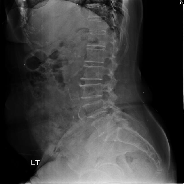 Dataset Image