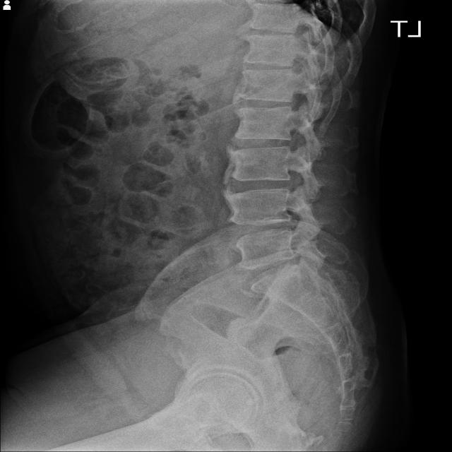 Dataset Image