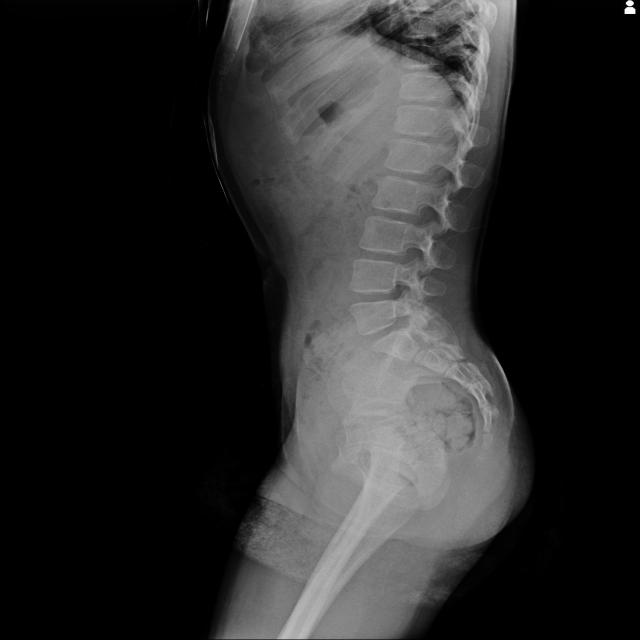 Dataset Image