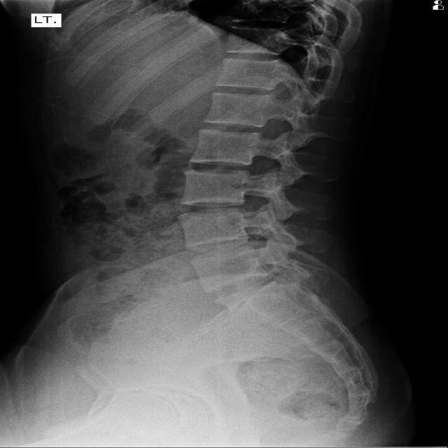 Dataset Image