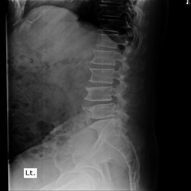 Dataset Image
