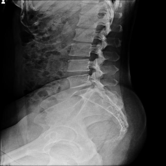 Dataset Image