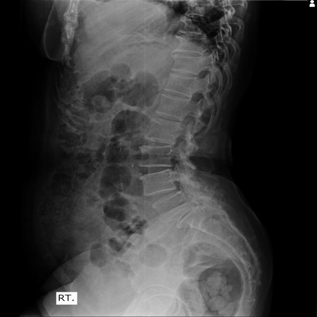 Dataset Image