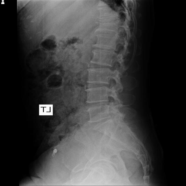 Dataset Image