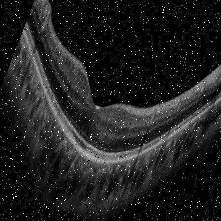 Dataset Image