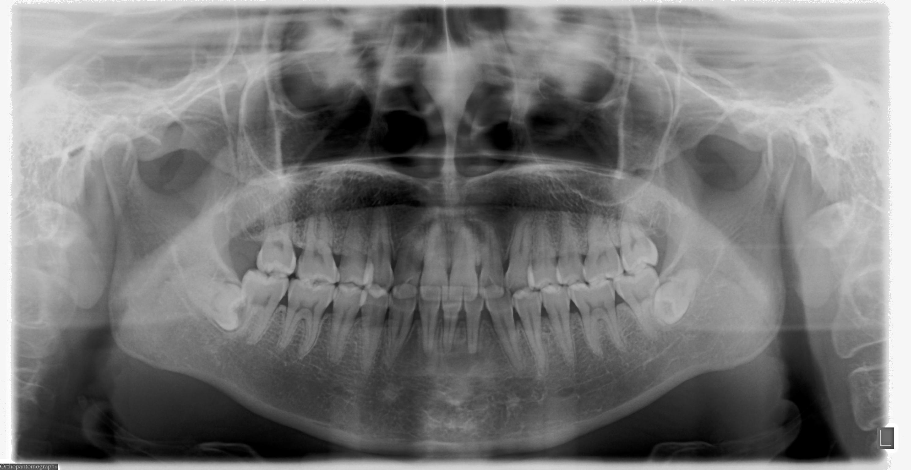 Dataset Image