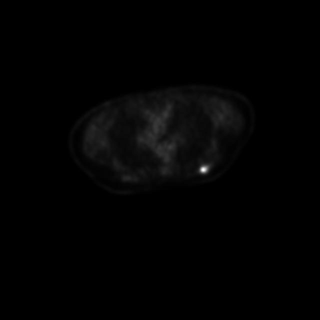 Dataset Image