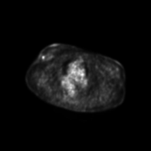 Dataset Image