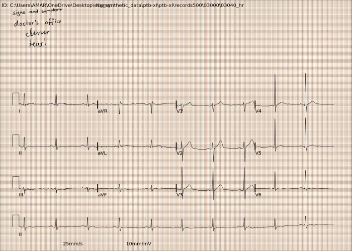 Dataset Image