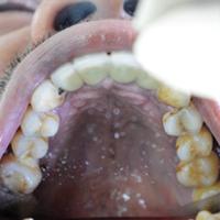 Dataset Image