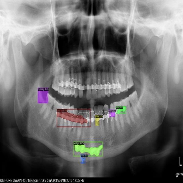 Dataset Image