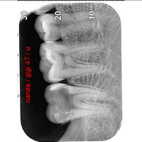 Dataset Image