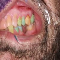 Dataset Image