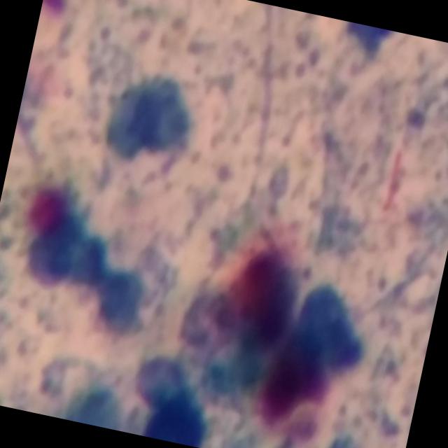 Dataset Image