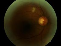 Dataset Image