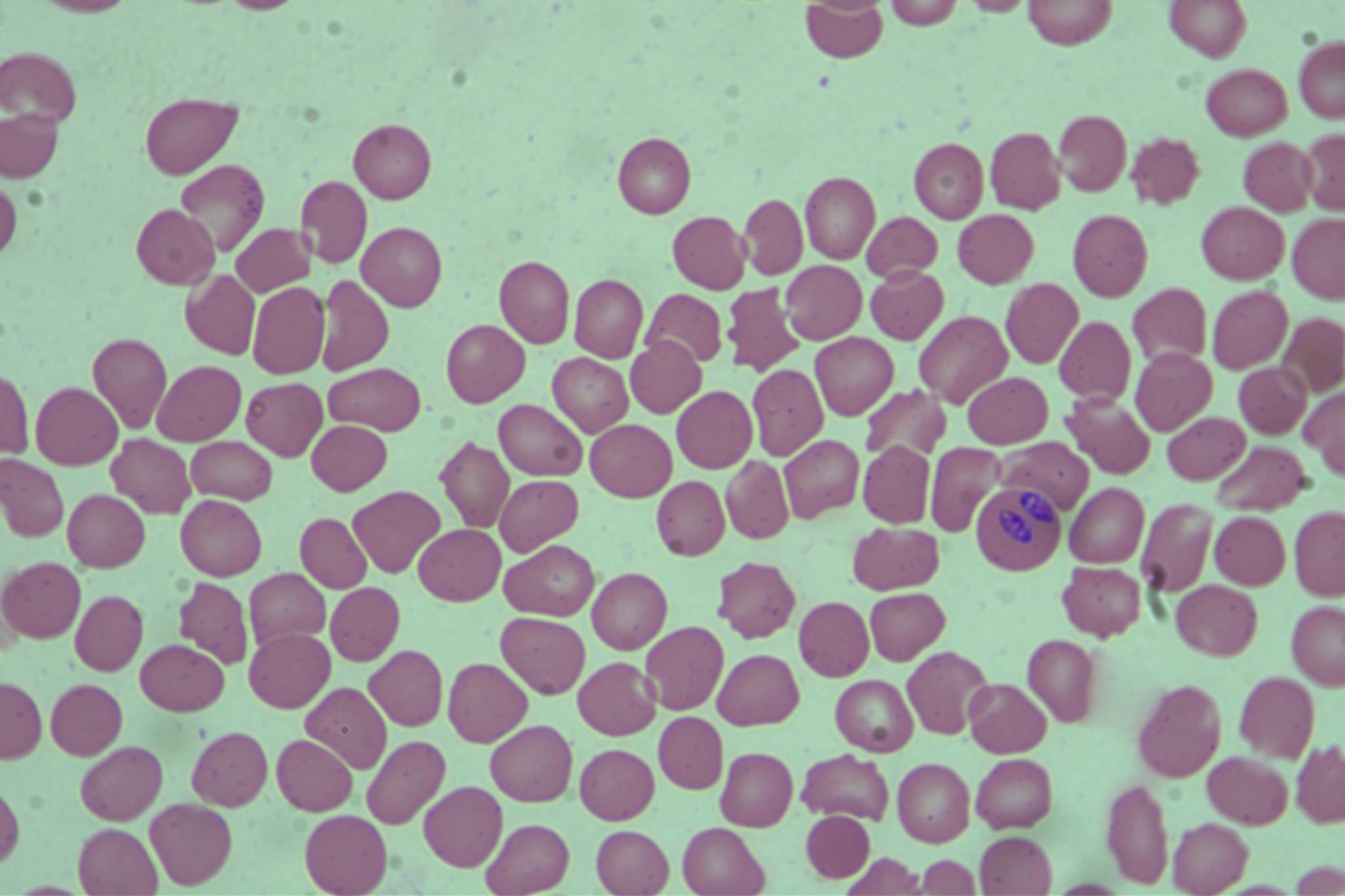 Dataset Image