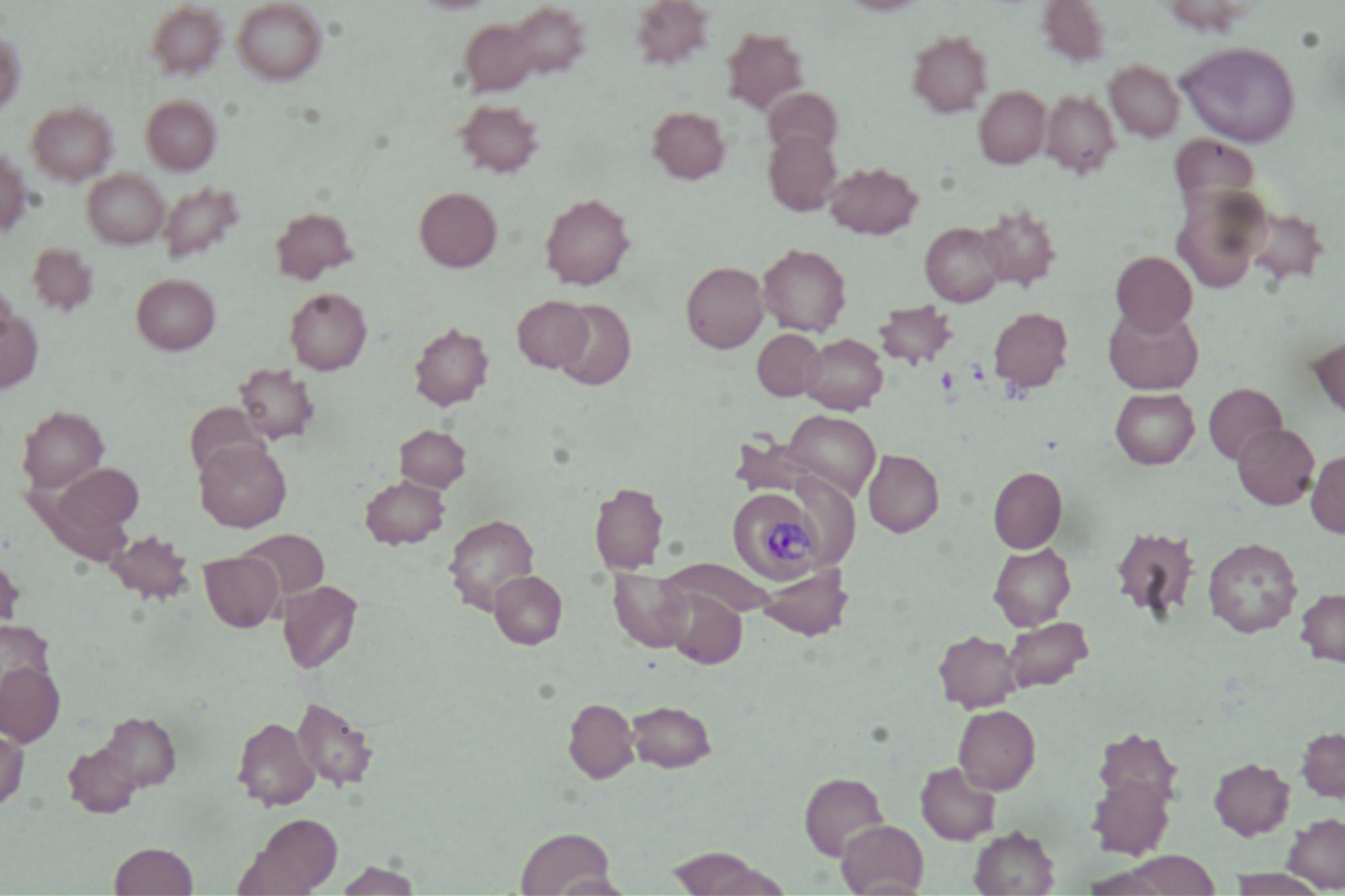 Dataset Image