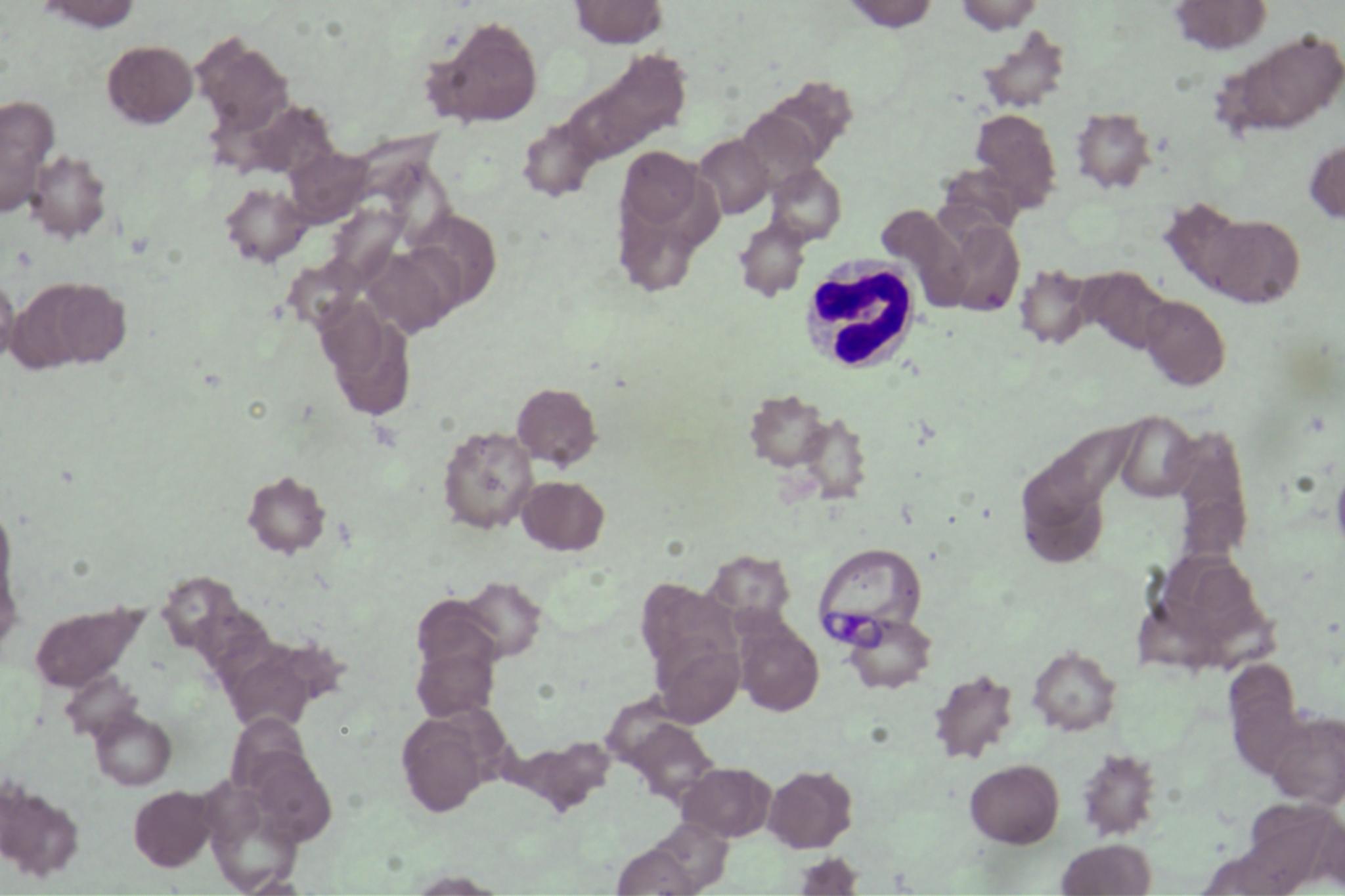 Dataset Image