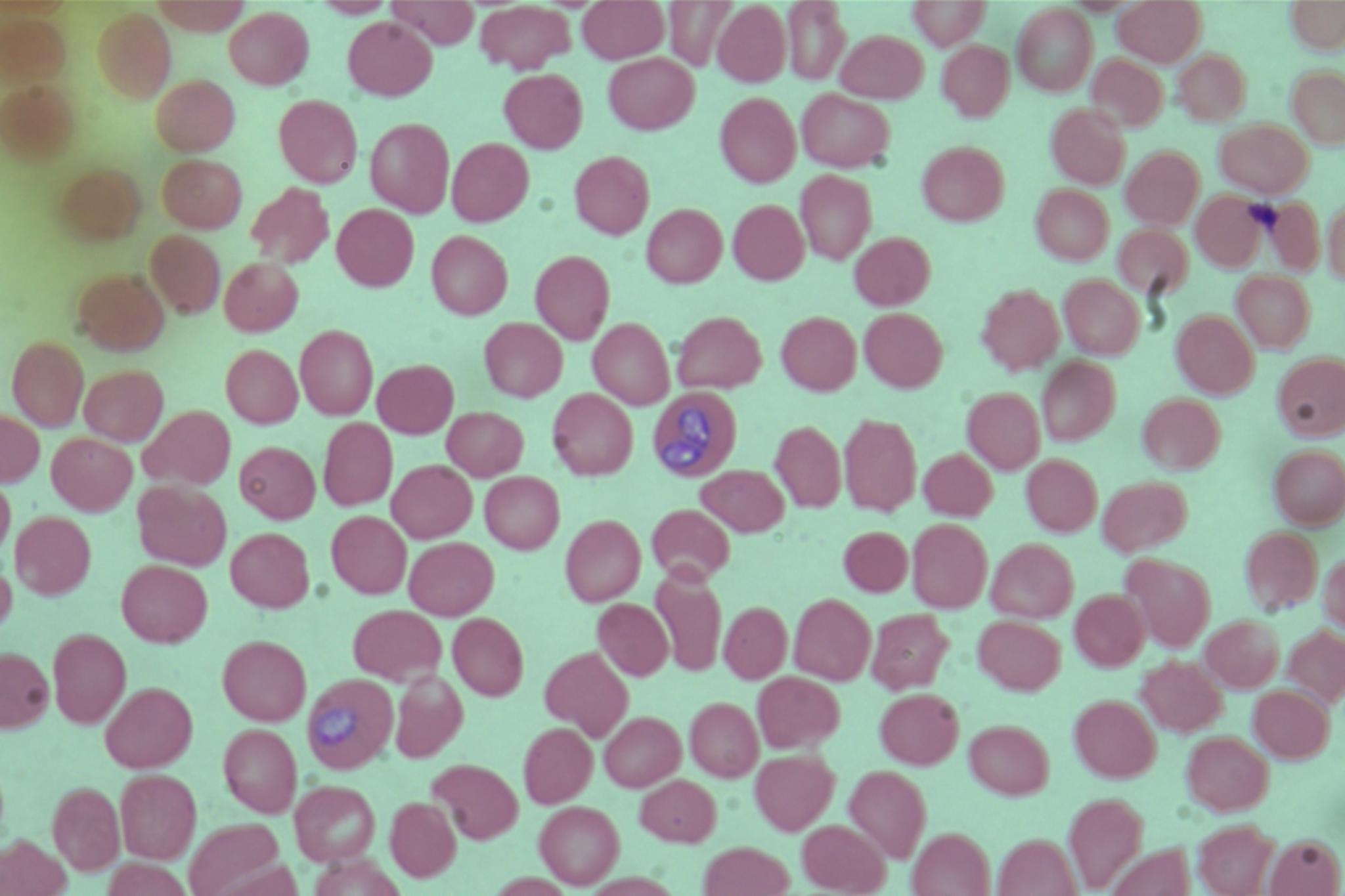 Dataset Image