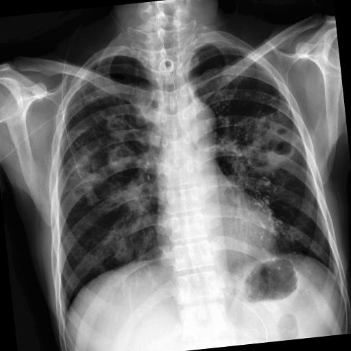 Dataset Image