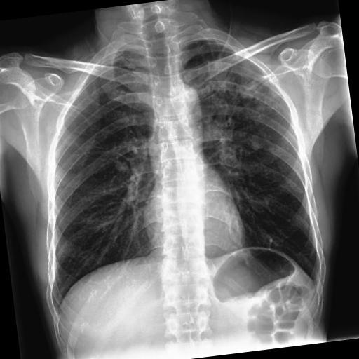 Dataset Image