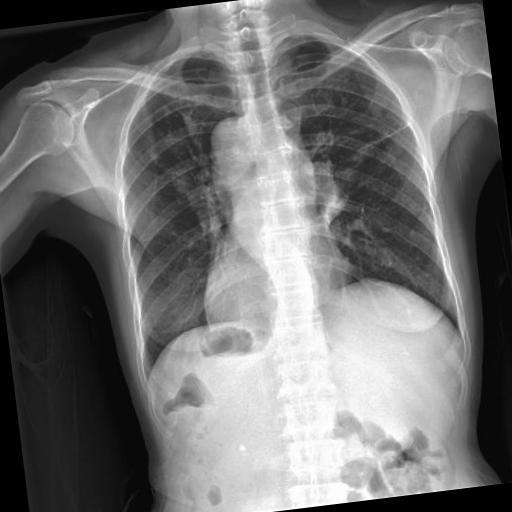 Dataset Image