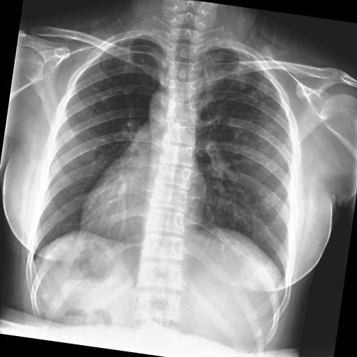 Dataset Image