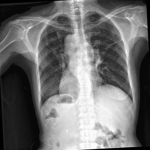 Dataset Image