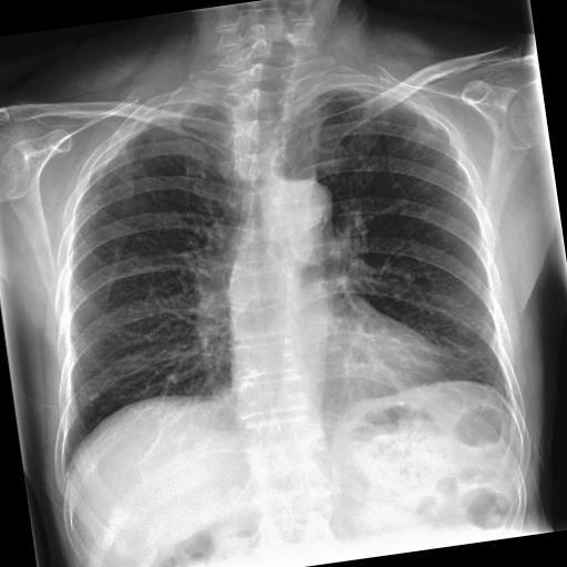 Dataset Image