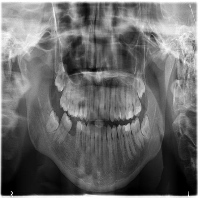 Dataset Image