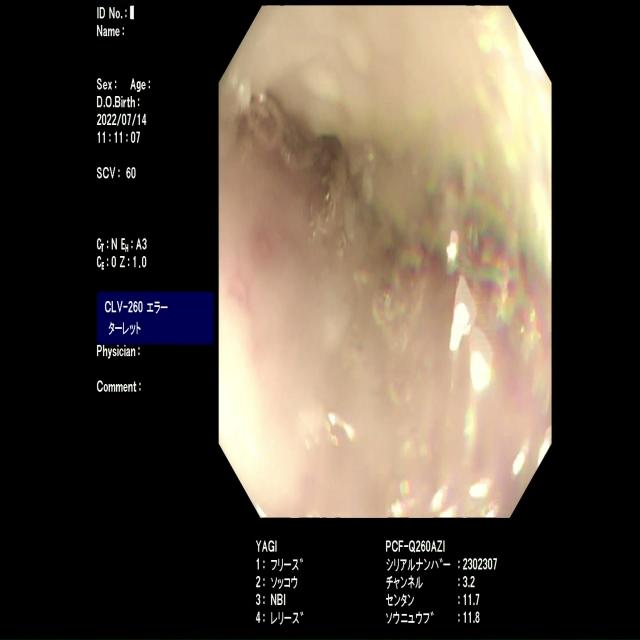 Dataset Image