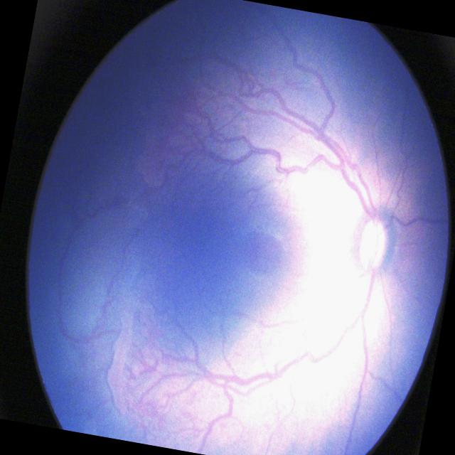 Dataset Image