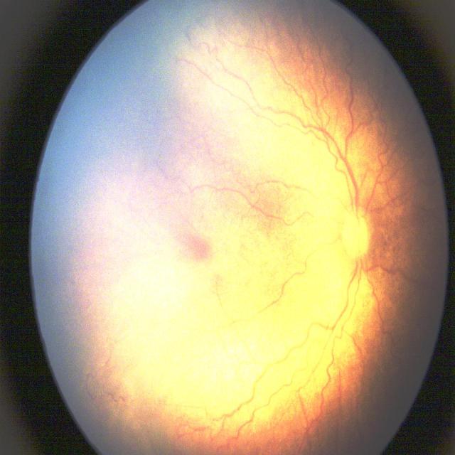 Dataset Image