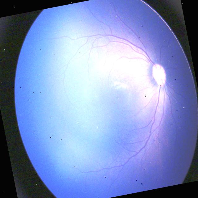 Dataset Image