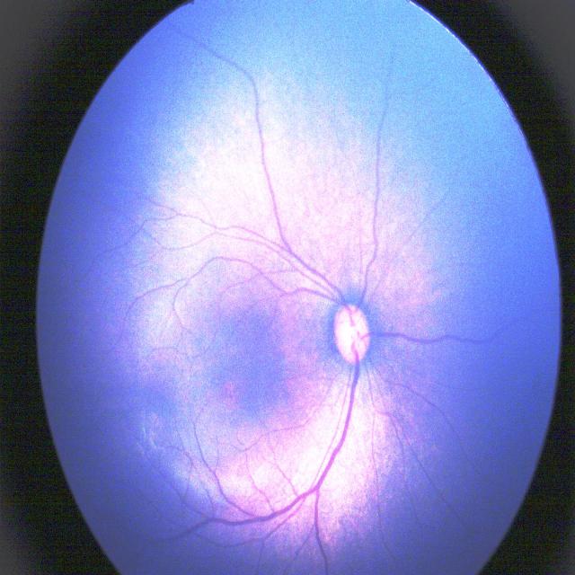 Dataset Image
