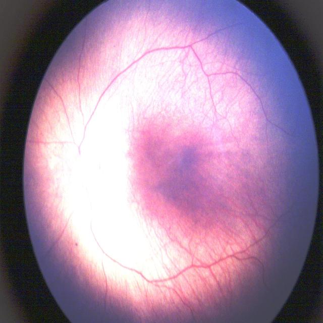 Dataset Image