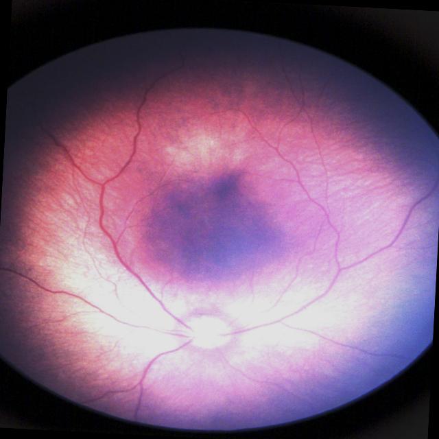 Dataset Image
