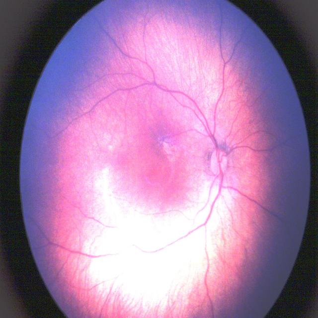 Dataset Image