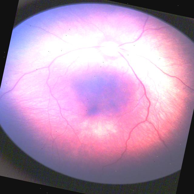 Dataset Image