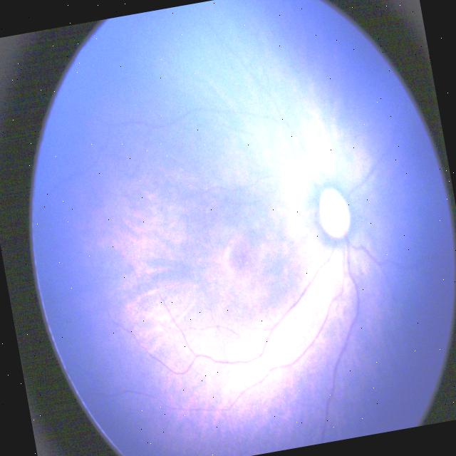 Dataset Image